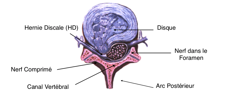 Contenu Du Petit Foramen Sciatique