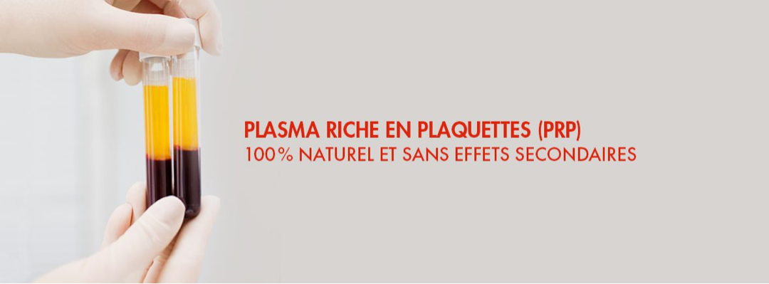 Arthrose : intérêt d’une injection de Plasma Riche en Plaquettes (PRP)