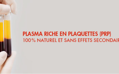Arthrose du genou : intérêt d’une injection de Plasma Riche en Plaquettes (PRP)